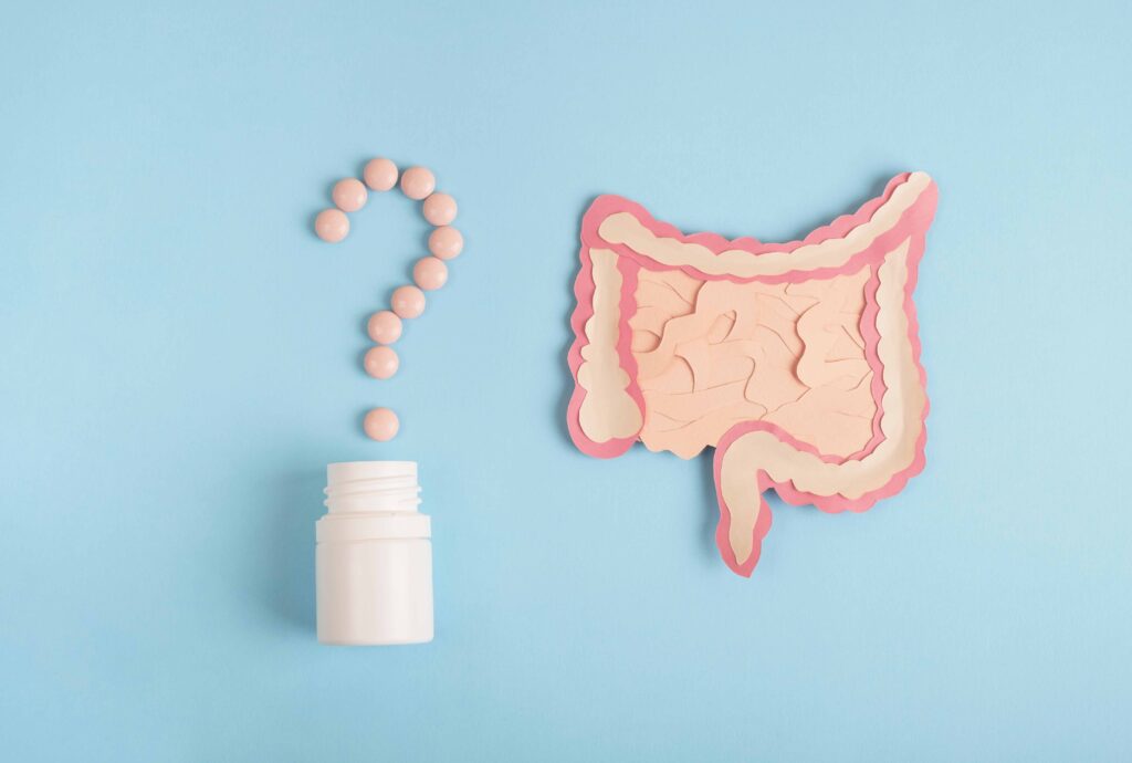 How to choose a prebiotic ingredient